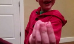 拔牙视频,揭秘拔牙全过程